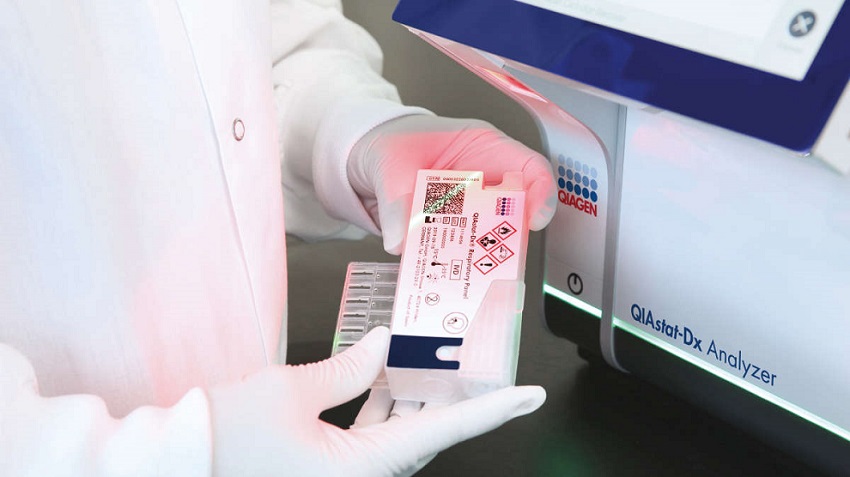 Imagen: El panel respiratorio QIAstat-Dx Plus ha recibido la autorización de la FDA  de EUA (foto cortesía de QIAGEN)